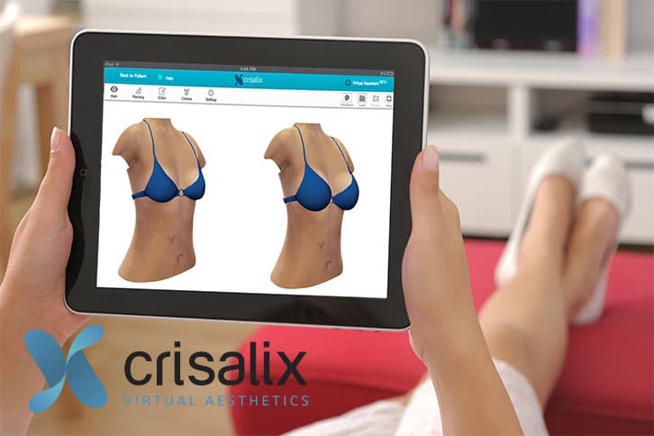 crisalix virtual aesthetics
