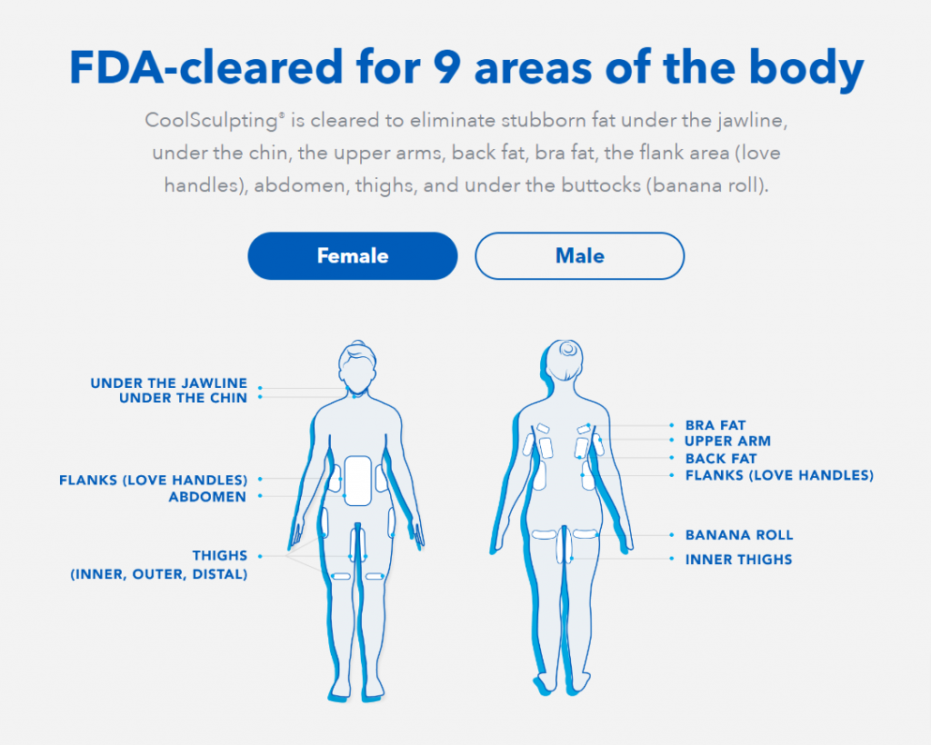 Diagram of 9 areas of the body that can be treated CoolSculpting®